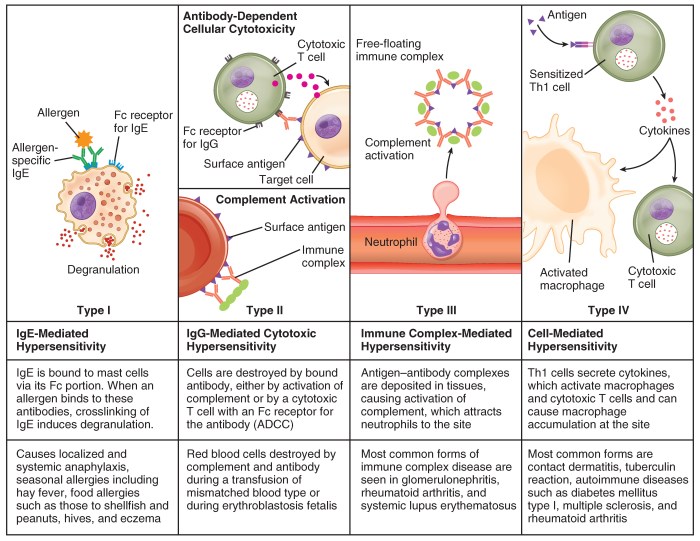 Which of the following examples below describes an autoimmune disease