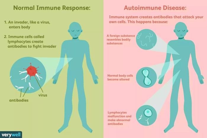 Which of the following examples below describes an autoimmune disease